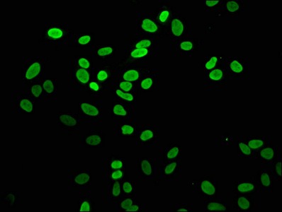 Anti-Mono-methyl-Histone H2AZ (K4) Antibody