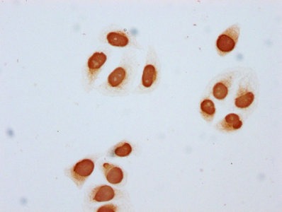 Anti-Acetyl-Histone H2B type 1-C (K85) Antibody