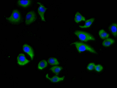 Anti-ABCC6 Antibody