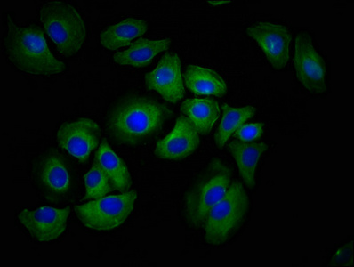 Anti-HAS1 / Hyaluronan synthase 1 Antibody