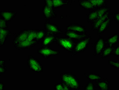 Anti-NCOR1 Antibody
