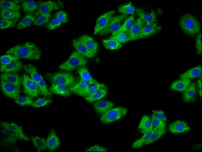 Anti-REM1 Antibody