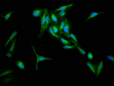 Anti-RIN1 Antibody