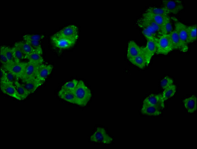 Anti-GPR52 Antibody