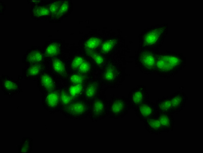 Anti-SOX21 Antibody