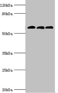 Anti-ABAT / GABA transaminase Antibody