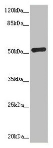 Anti-ADPGK Antibody