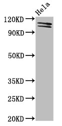 Anti-UBA1 Antibody