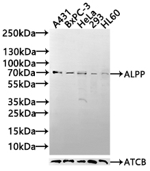 Anti-ALPP Antibody