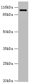 Anti-AP2A2 Antibody