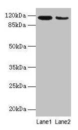 Anti-ATP2A2 / SERCA2 Antibody