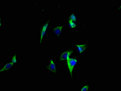 Anti-ATP2C2 Antibody