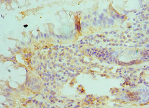 Anti-BLMH Antibody
