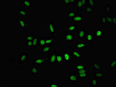 Anti-BTAF1 Antibody
