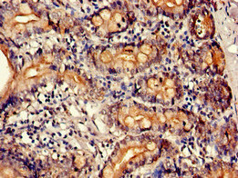Anti-PTBP1 Antibody