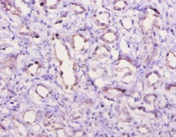 Anti-C5 / Complement C5a anaphylatoxin Antibody