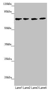 Anti-Complement component C8 beta Antibody
