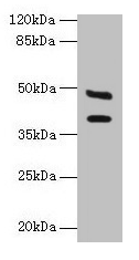 Anti-CA12 Antibody
