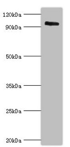 Anti-CAPN3 Antibody
