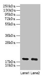 Anti-UBE2I Antibody