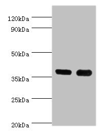 Anti-CD1A Antibody