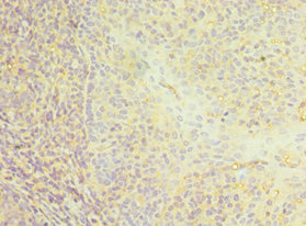 Anti-CD22 Antibody