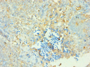 Anti-CD38 Antibody