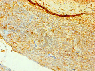Anti-CD4 Antibody