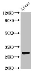 Anti-CDX1 Antibody