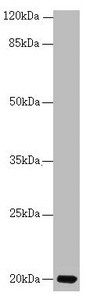 Anti-CETN3 / Centrin 3 Antibody