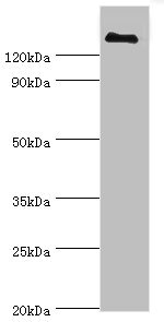 Anti-CFH Antibody
