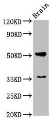 Anti-Chrm1 Antibody