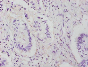 Anti-RPL14 Antibody