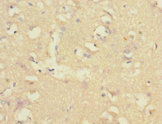 Anti-CNTNAP1 Antibody