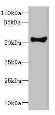 Anti-COCH Antibody