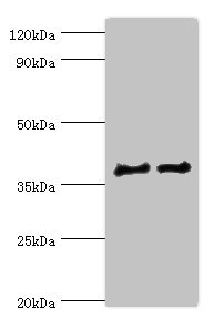 Anti-CTSV Antibody