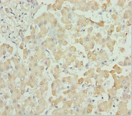Anti-CXCL14 Antibody