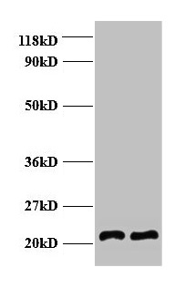 Anti-AP2M1 Antibody