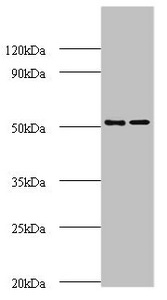 Anti-AP2M1 Antibody