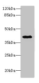 Anti-DCN Antibody