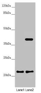 Anti-DCTN6 Antibody