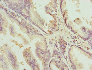 Anti-DEDD Antibody