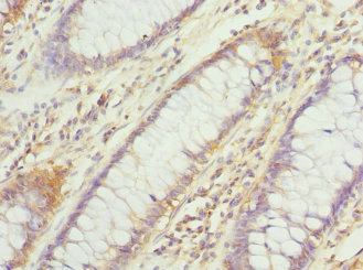 Anti-DHDDS Antibody