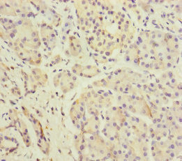 Anti-DPT Antibody