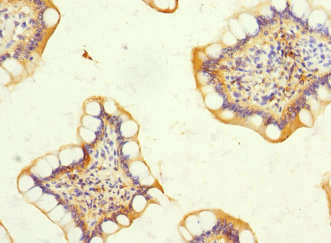 Anti-DSC2 Antibody