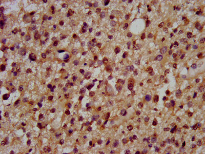 Anti-DSCAM Antibody