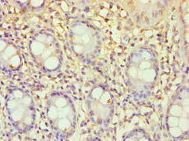 Anti-ECE2 Antibody