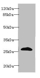 Anti-EFNA3 Antibody