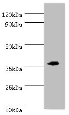 Anti-EFNB2 Antibody