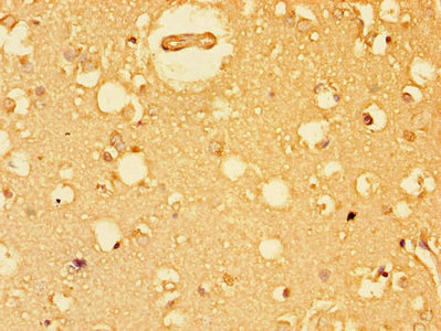 Anti-EIF4E Antibody